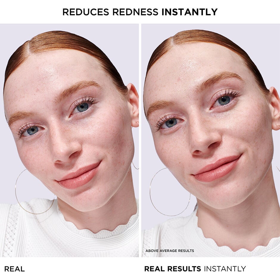Bye on sale bye redness